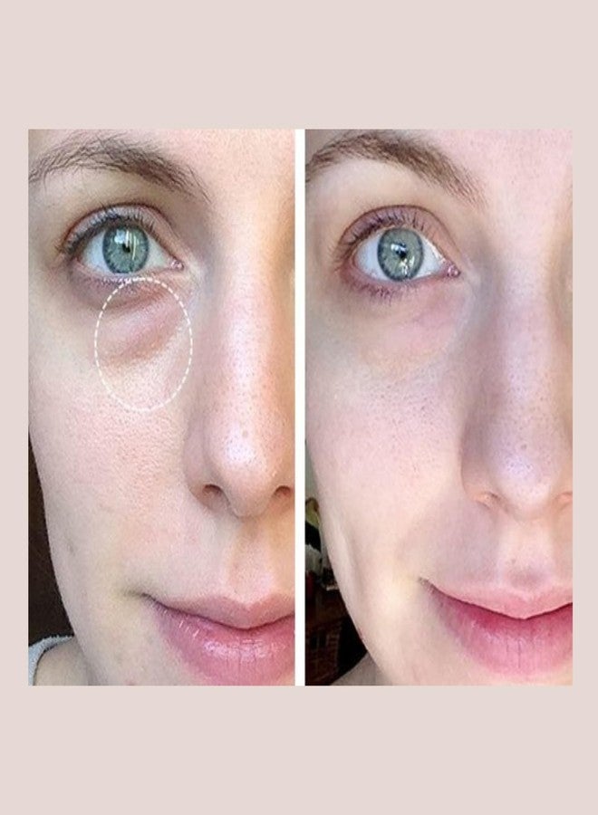 كريم إيفر النهاري لتفتيح منطقة العين - علاج مرطب ومشد للبشرة، يعالج الهالات السوداء والانتفاخات والخطوط الدقيقة والتجاعيد - 15 مل - Image 4